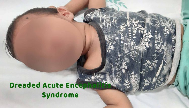 readed Acute Encephalitis Syndrome